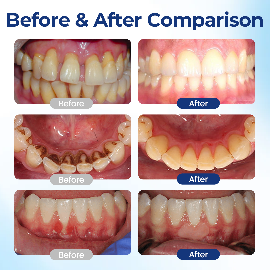 ToothPower™ – Tooth & Gum Strength