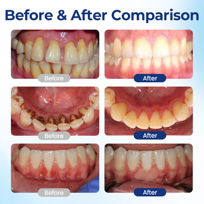 ToothPower™ – Tooth & Gum Strength